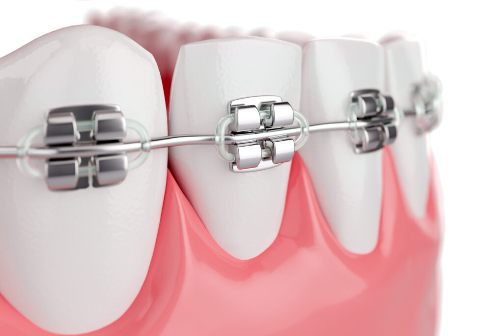 Orthodontic Dentistry - Absecon Family Dental, P.A.©: Emergency